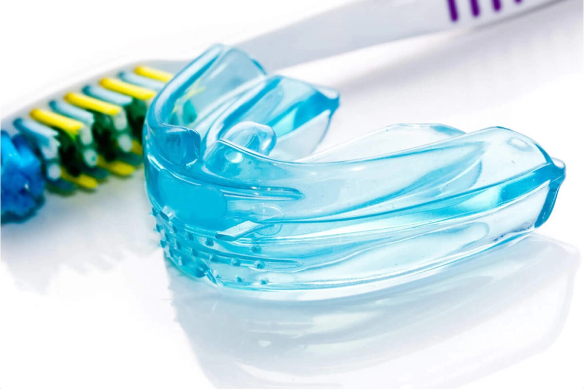 Custom Mouth Guards at Gateway Dental