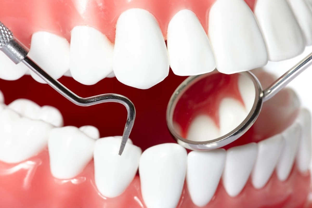Oral Hygiene Care at Gateway Dental