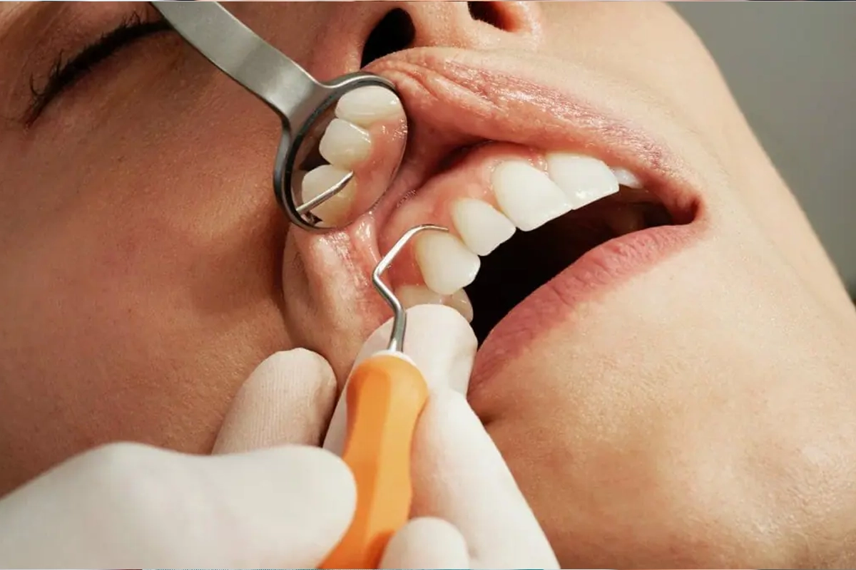 Preventive Dentist at Gateway Dental