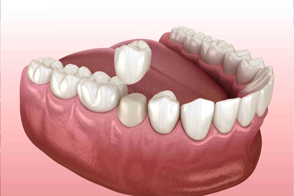 Restorative Dentist at Gateway Dental