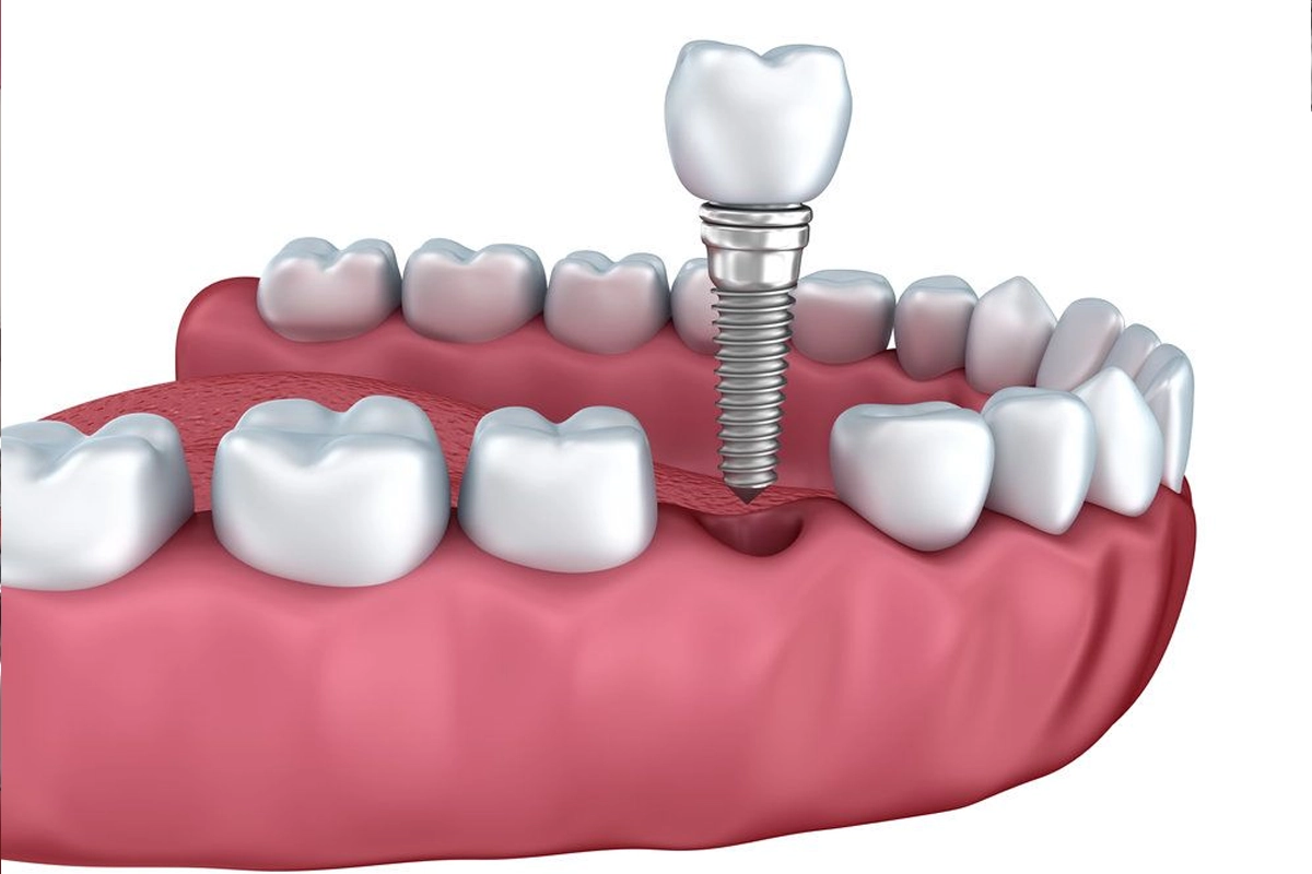 Restorative Dentist at Gateway Dental