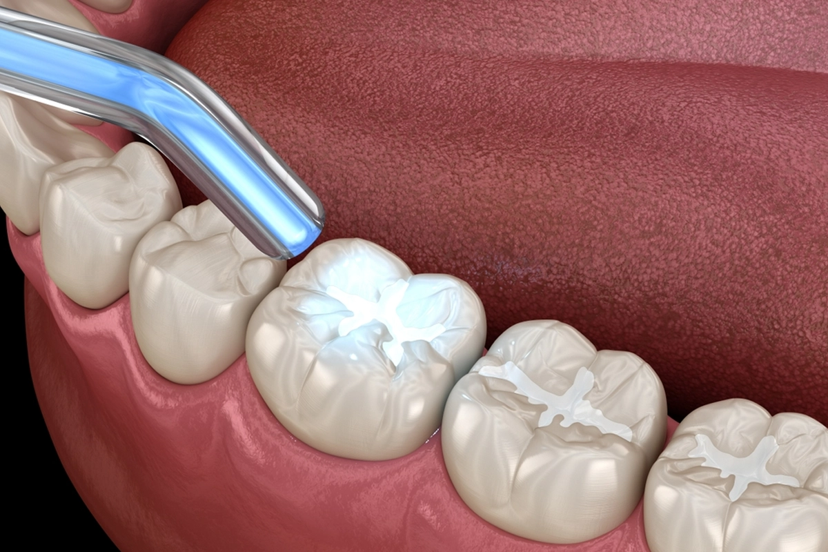 Restorative Dentist at Gateway Dental
